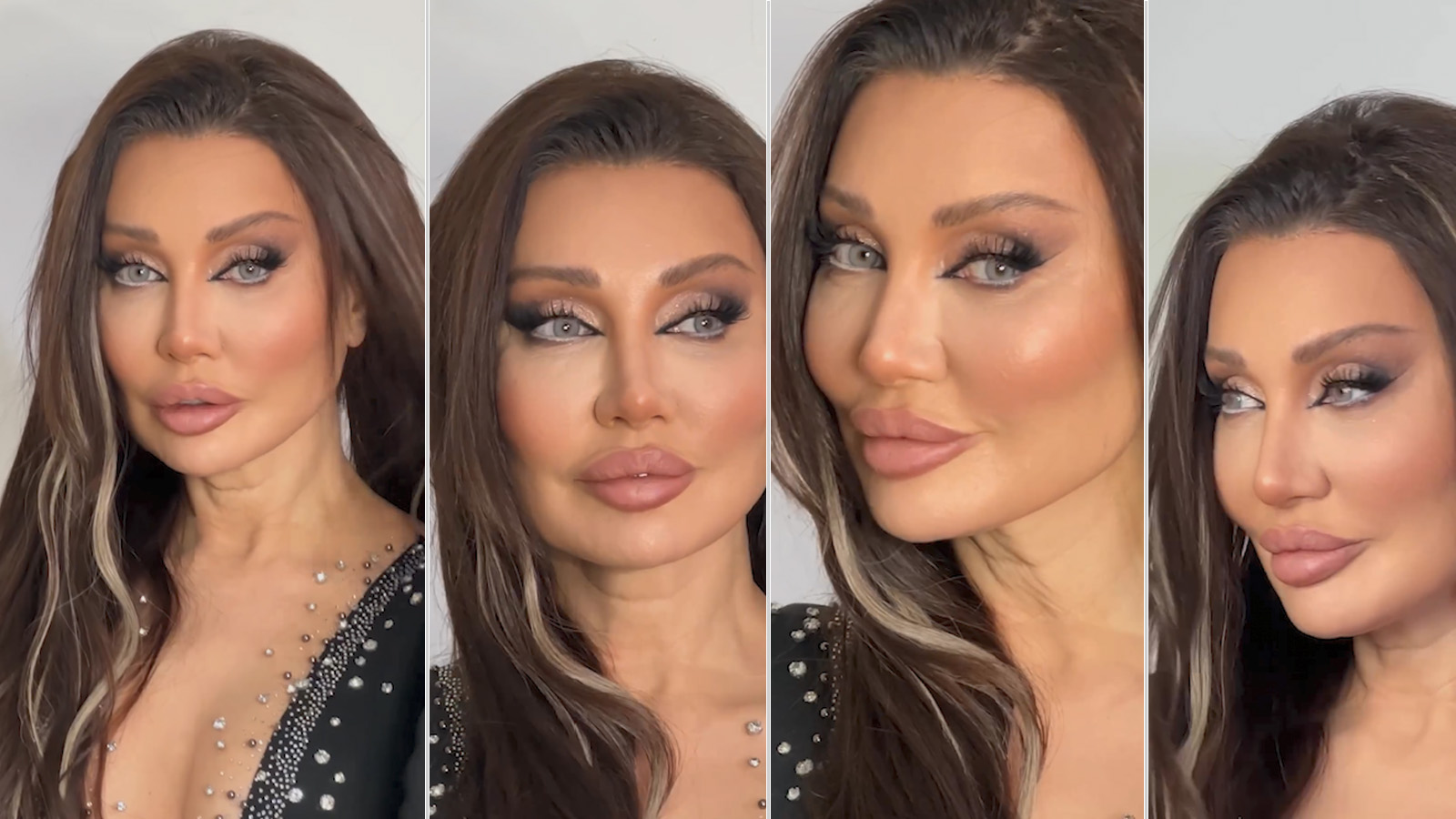 Alın daraltma ameliyatı olan Umut Akyürek yüzünün son halini paylaştı - Gazete Pencere